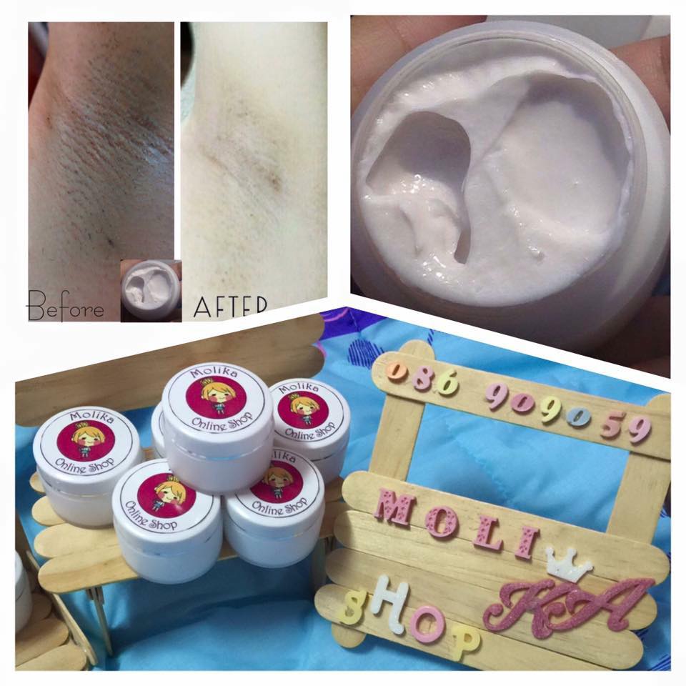 Whitening Armpit Cream